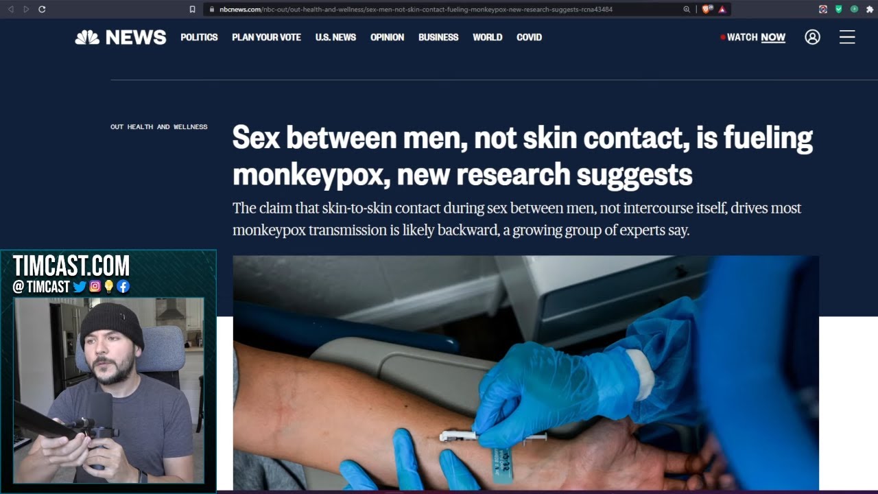 NBC Says MonkeyPox IS Mostly Spread Via Sex, Children And Dog ...